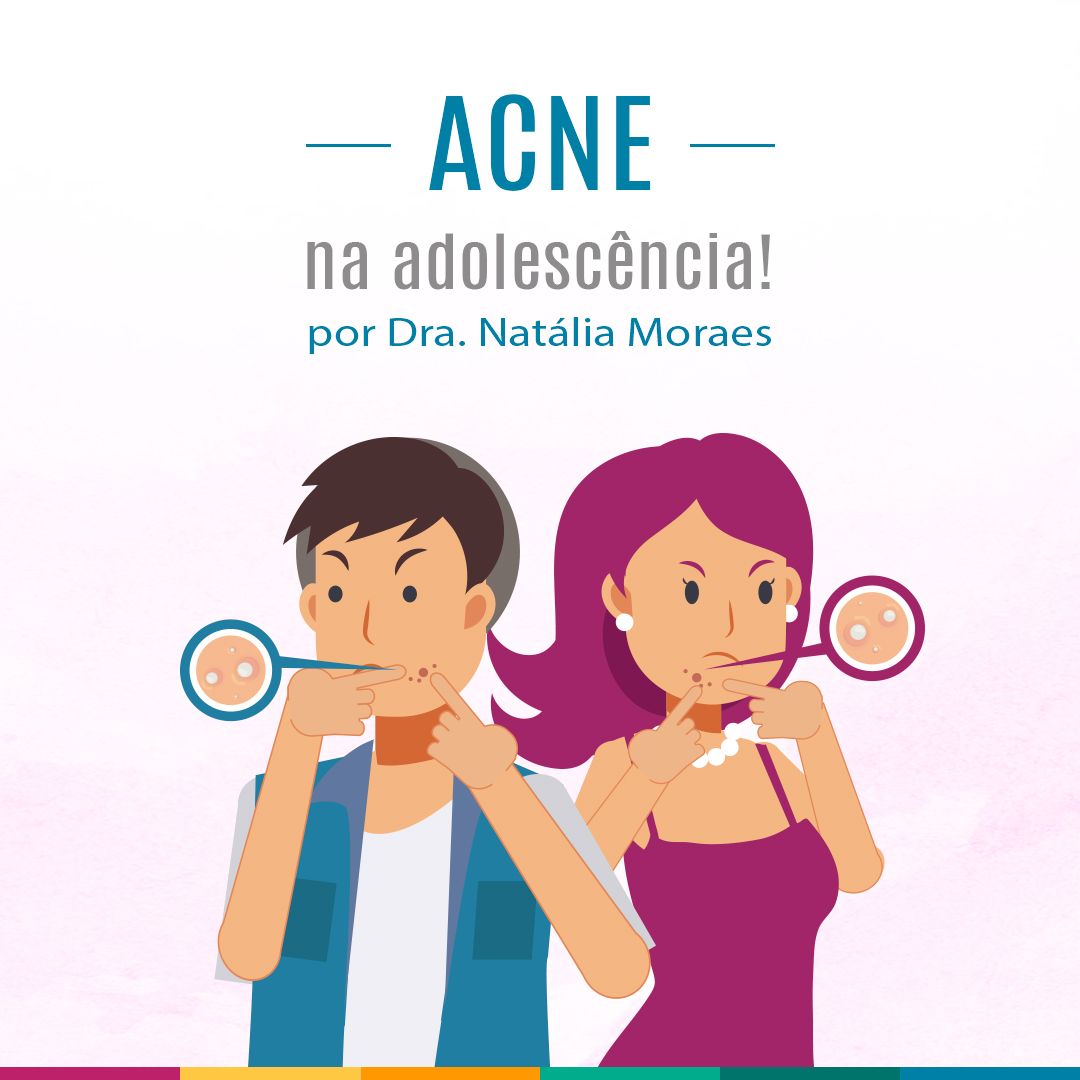 Ícone do tratamento de Acne na adolescência!